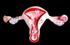 Причины и последствия гипотиреоза во время беременности